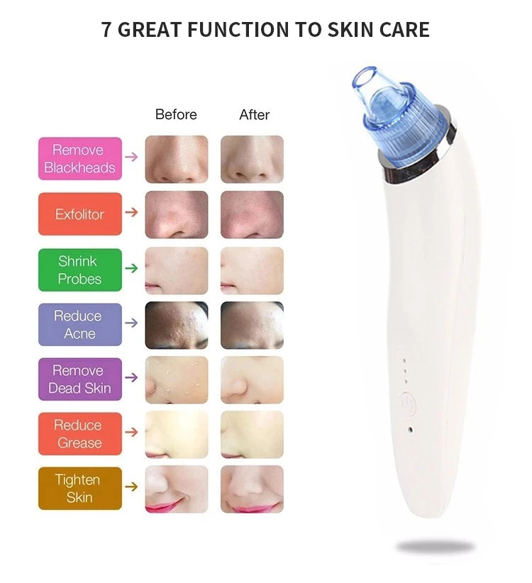 Hot Balckhead Vacuum Suction Blackhead  Nose Care Beauty Face Massager Blackhead Remover Machine