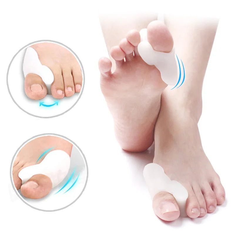 1pair Hallux Valgus Broadhurst Pad Remedical Bone Thumb Silica Gel Daily Use Silicone Foot Care Sets Toe Bunion Protector