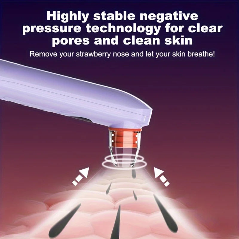 Professional Blackhead Remover Vacuum for Clear Skin