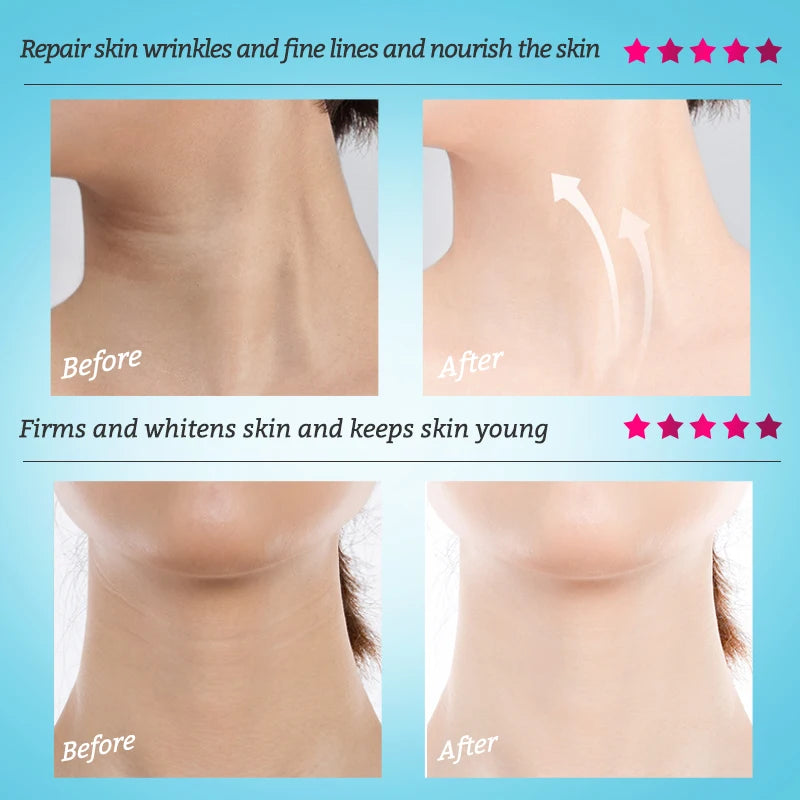 RtopR Neck Firming Wrinkle Remover Cream Rejuvenation Firming Skin Whitening Moisturizing Shape Beauty Neck Skin Care Products